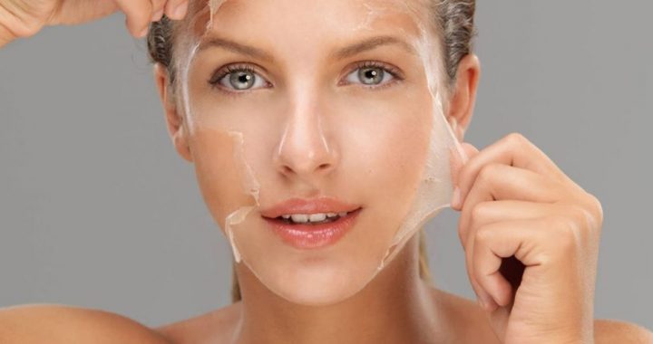 Chemical Peels