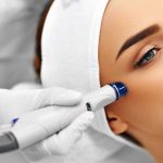Microdermabrasion