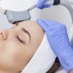 Photofacial Treatment in Lahore , Photofacial Treatment in Pakistan