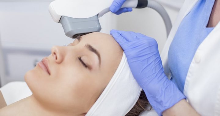 Photofacial Treatment