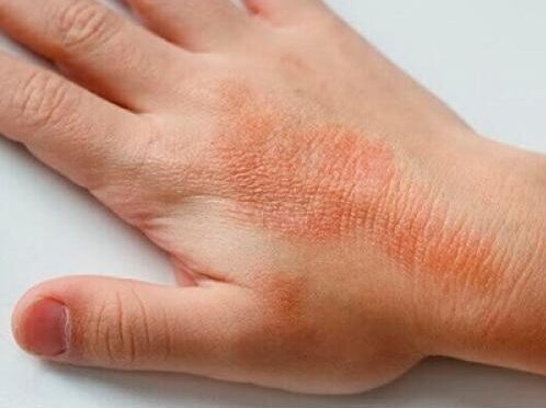 Top rated skin doctor in Pakistan