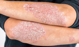 best skin specialist