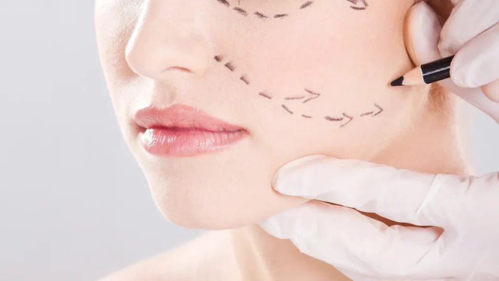 Face lift surgery for youthful facial skin glow
