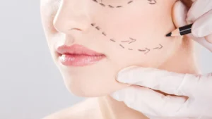 Face lift surgery for youthful facial skin glow