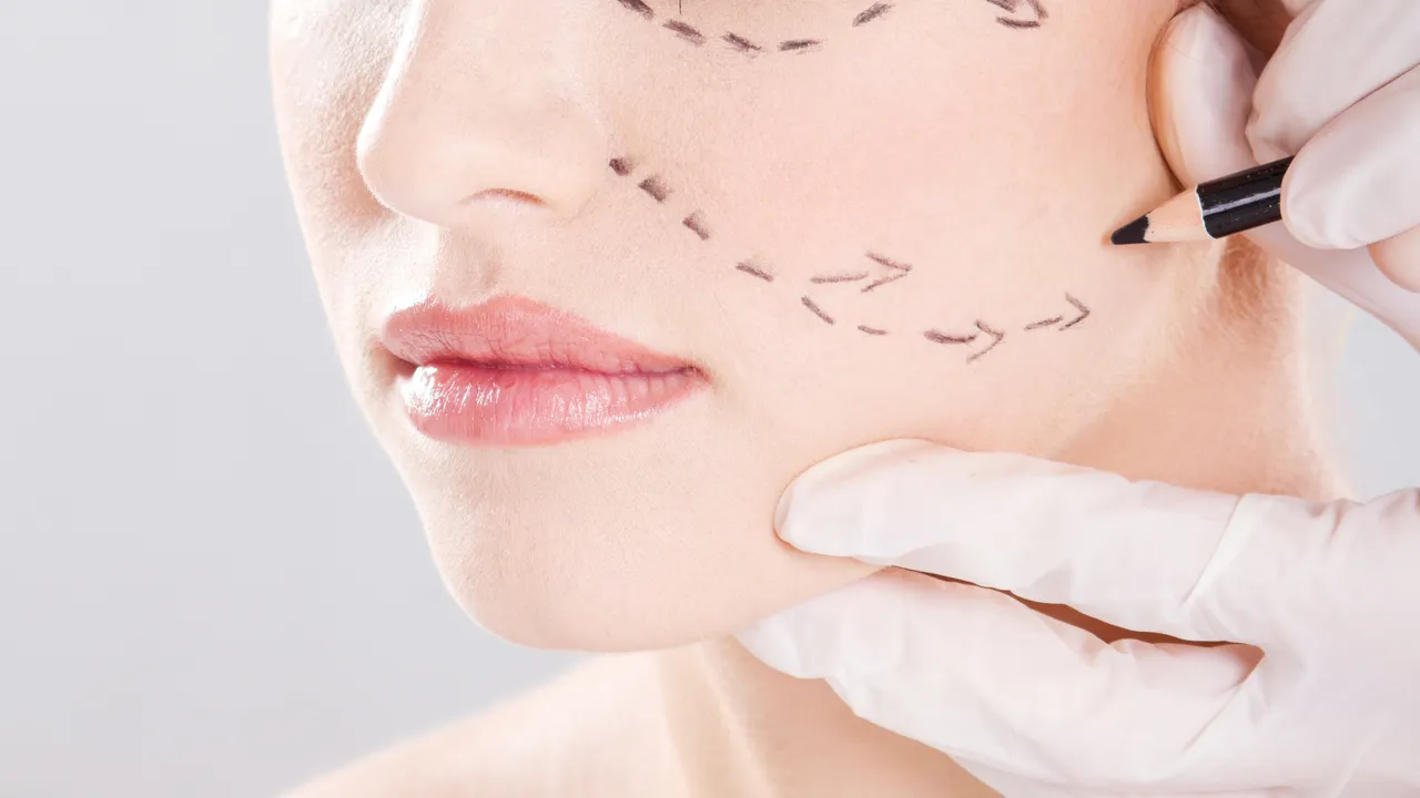 Face lift surgery for youthful facial skin glow