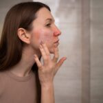 Skin specialist examining patient skin for diagnosis and treatment