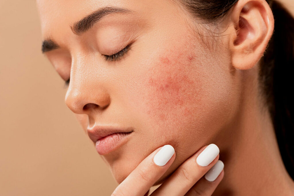Professional skin consultation with dermatologist in Lahore