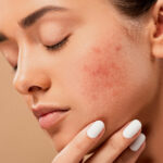 Professional skin consultation with dermatologist in Lahore
