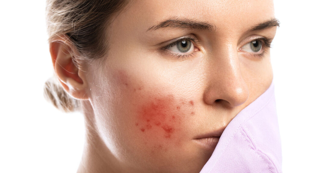 Tired of Dark Spots? Here's How a Skin Specialist Can Help