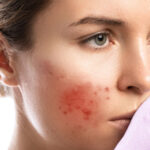 Tired of Dark Spots? Here's How a Skin Specialist Can Help