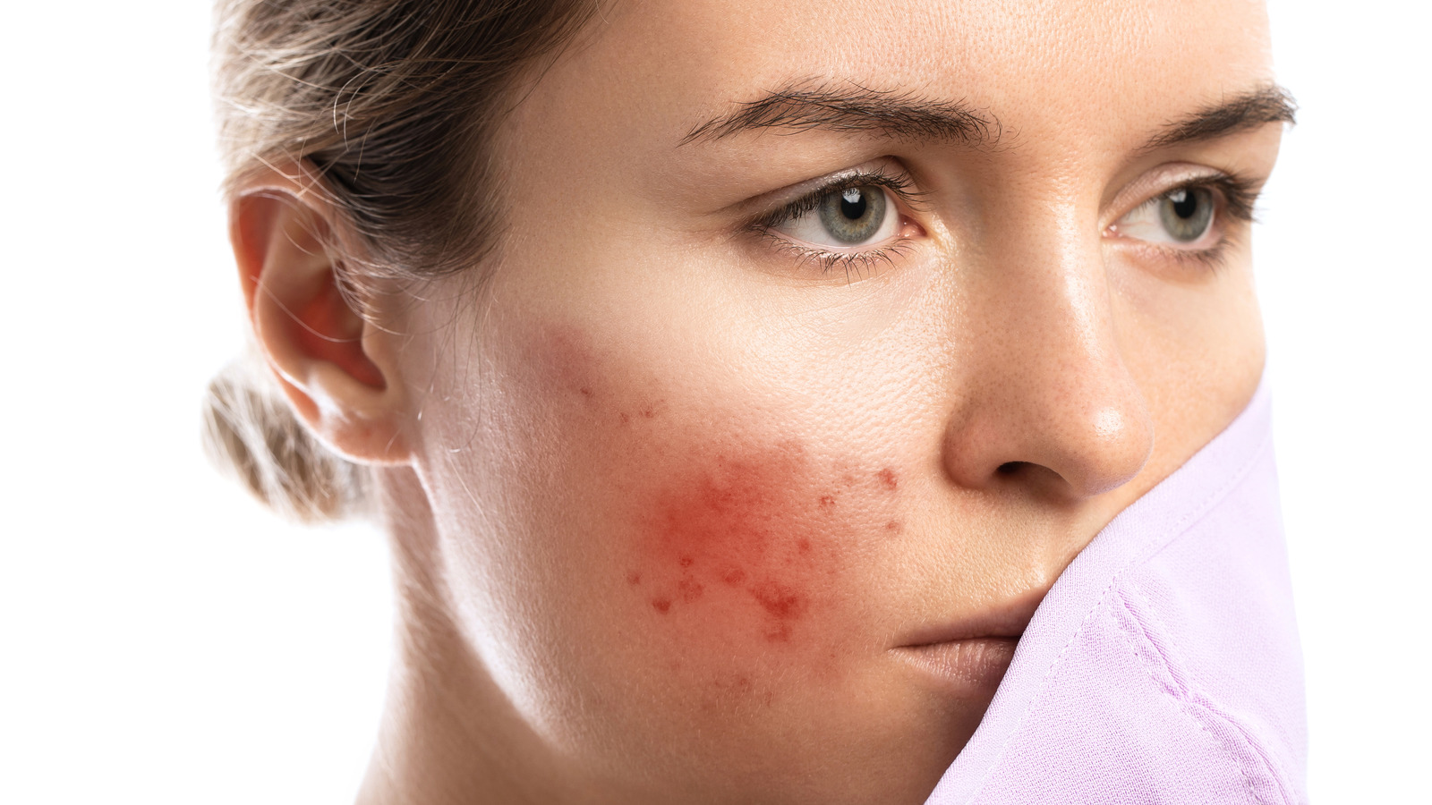 Tired of Dark Spots? Here's How a Skin Specialist Can Help