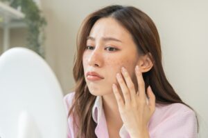 Skin specialist explaining common skincare mistakes that damage skin health