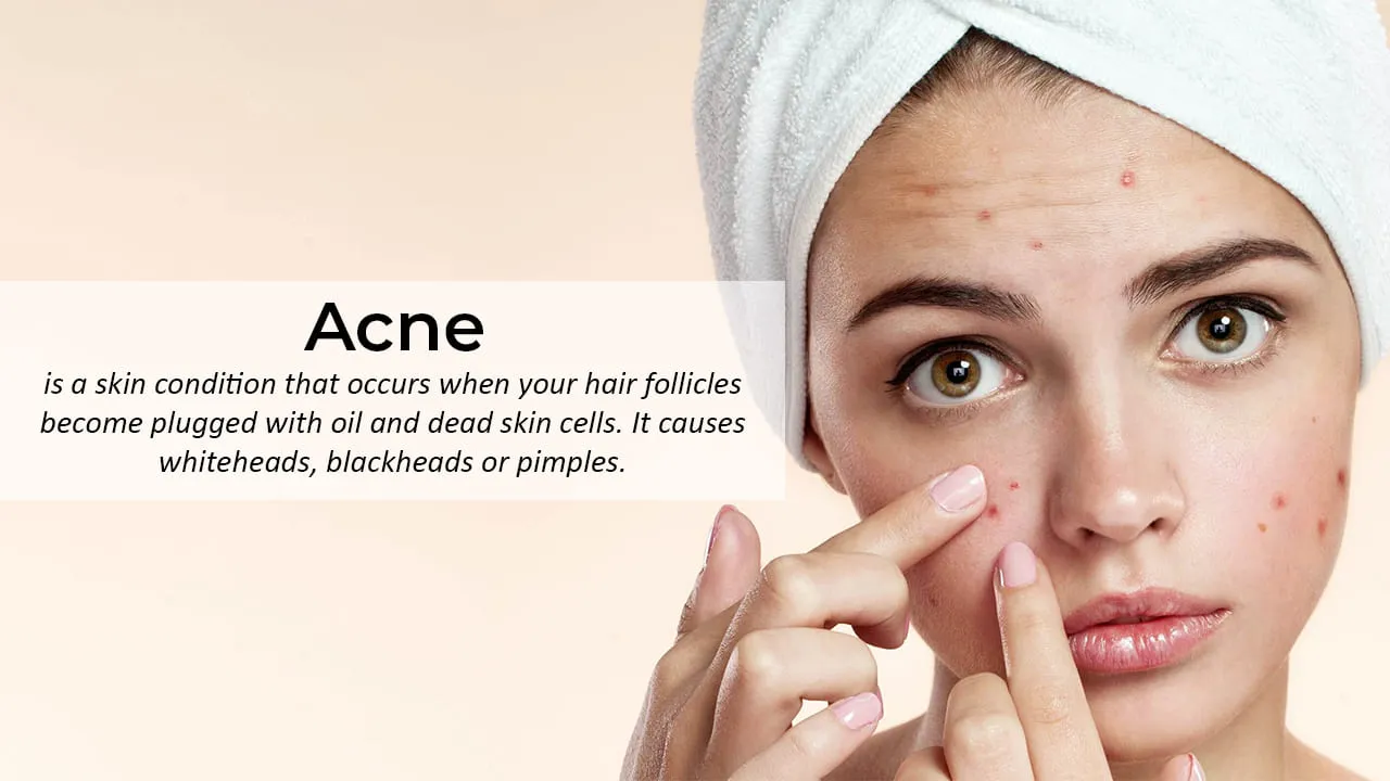 Acne Treatment