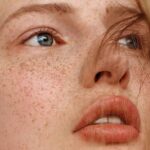 Skin specialist examining freckles on a patient’s face