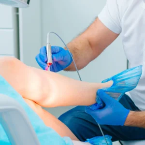 Laser treatment for leg vein procedure to reduce visible spider and varicose veins