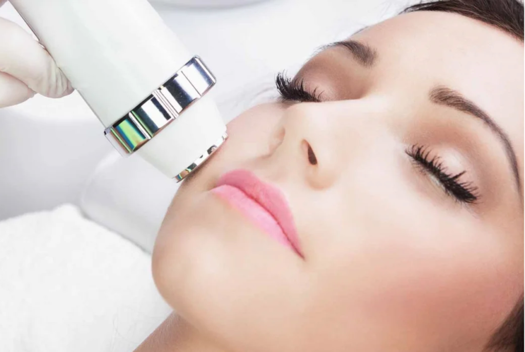 Microlaser Peel treatment for smoother skin texture and advanced laser skin resurfacing