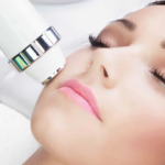 Microlaser Peel treatment for smoother skin texture and advanced laser skin resurfacing