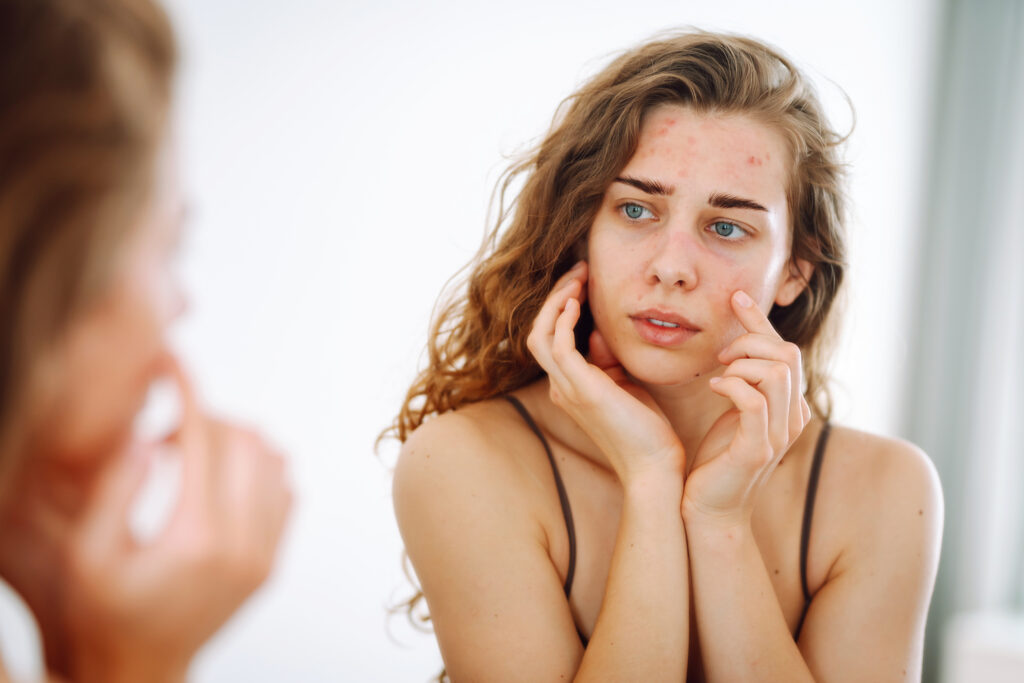 Skin care expert diagnosing skin problems