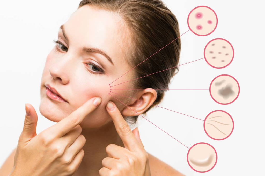 Clear skin care for acne, dark spots, and blemishes