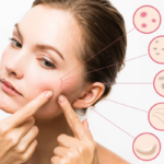 Clear skin care for acne, dark spots, and blemishes