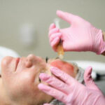 Vampire Facial treatment for skin rejuvenation and improved skin appearance