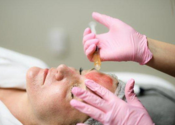 Vampire Facial treatment for skin rejuvenation and improved skin appearance