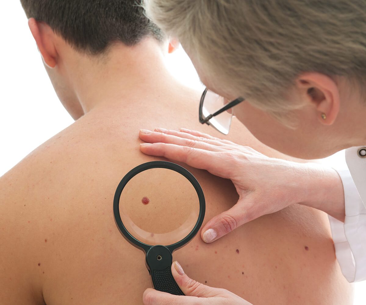 Mohs Surgery treatment best skin specialist in lahore