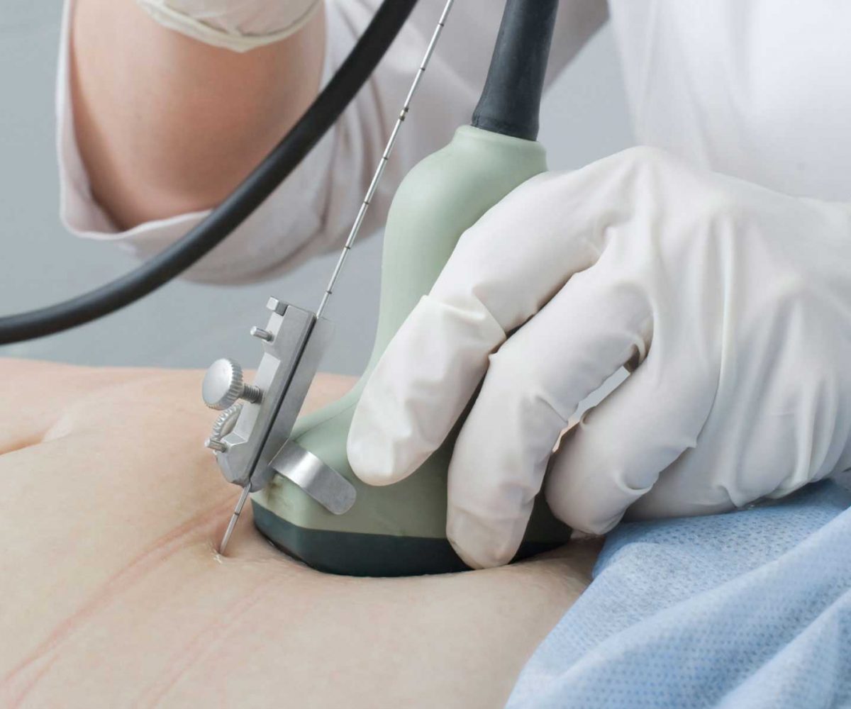Skin Biopsy Treatment best skin specialist in lahore