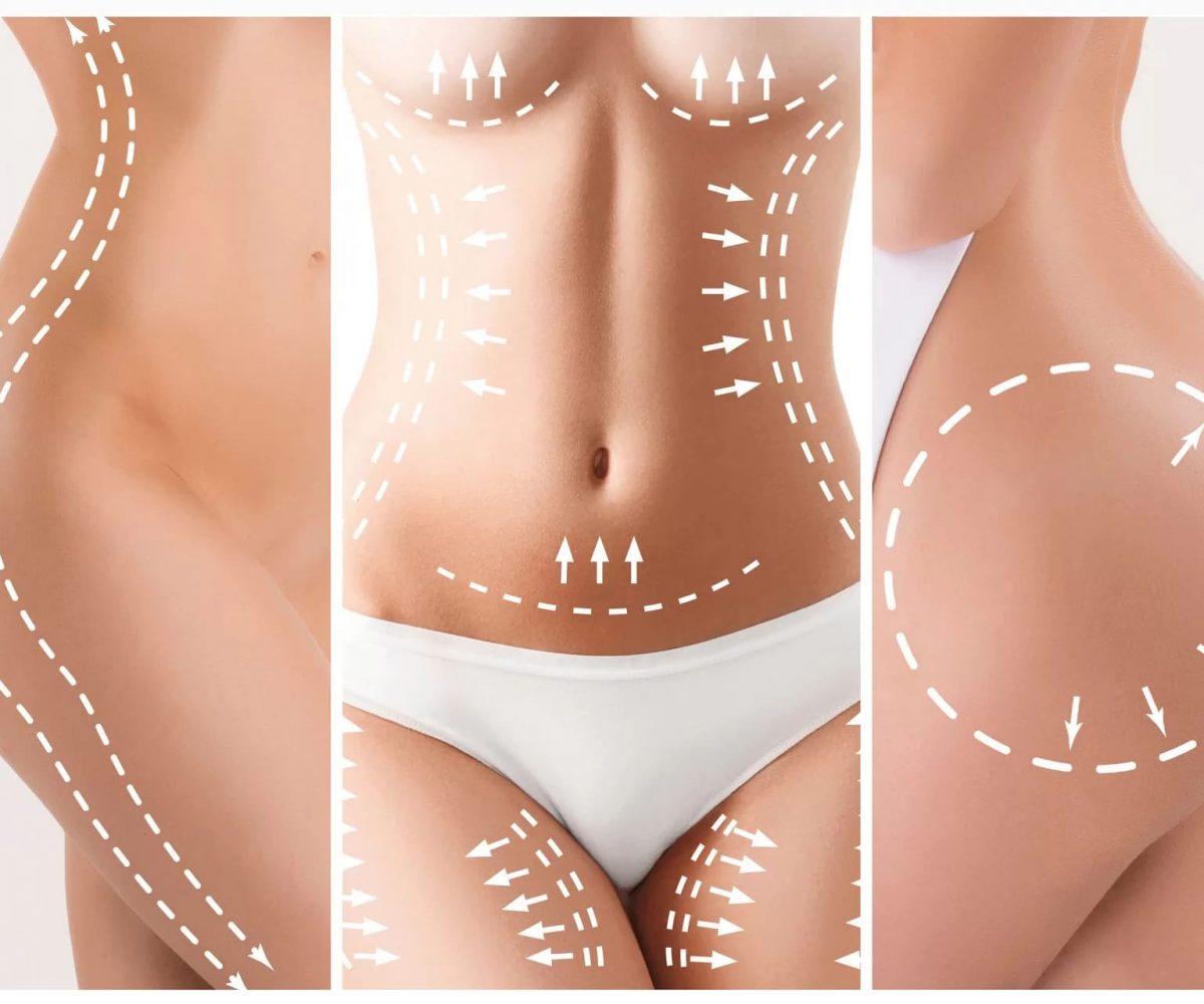 Tumescent Liposuction best skin specialist in lahore